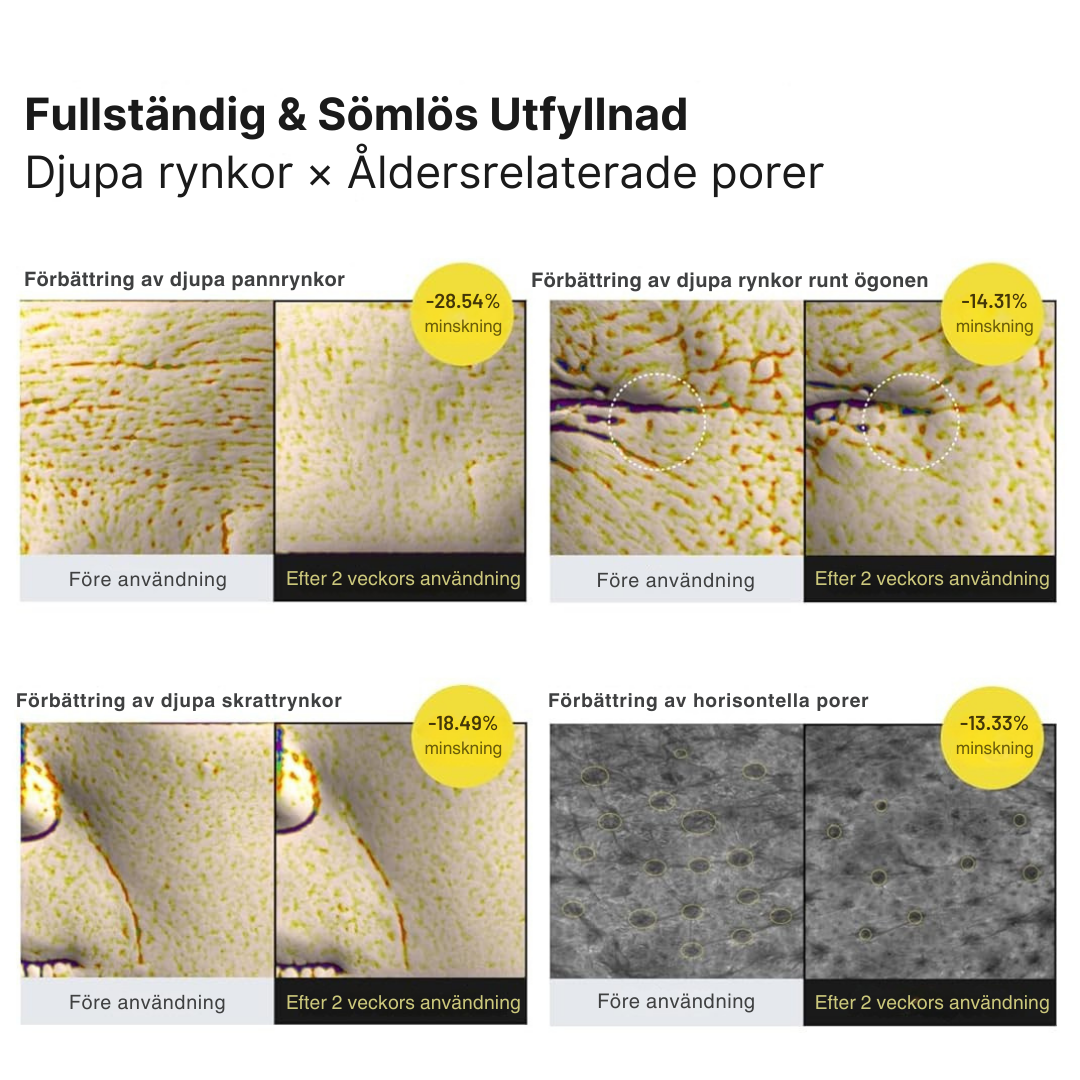 Vita-A Uppstramande Set (Serum + Booster)