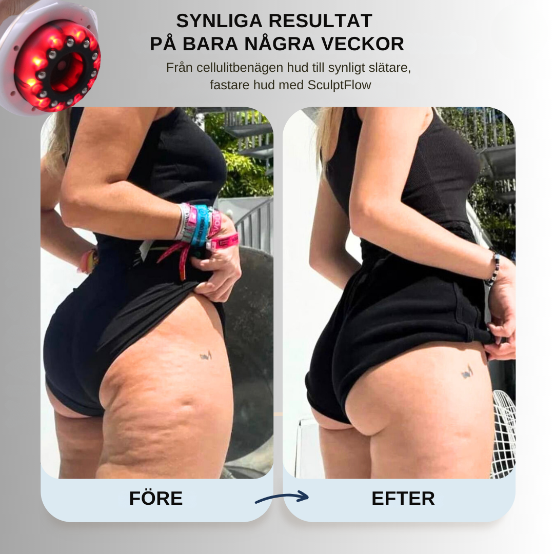 SculptFlow | Djupmassage för lättare ben & slätare hud
