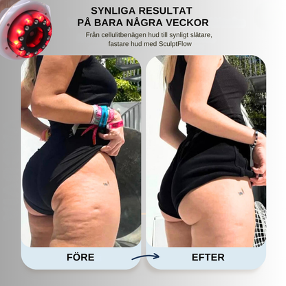 SculptFlow | Djupmassage för lättare ben & slätare hud